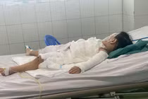 Tưởng chai nước ngọt bé 2 tuổi uống phải nước tẩy bồn cầu bỏng nặng