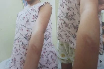 Hàng xóm không tố giác bạo hành có bị xử lý?