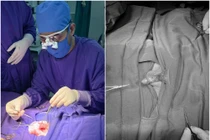 Các bác sĩ Bệnh viện Đa khoa tỉnh Quảng Ninh khuyến cáo: