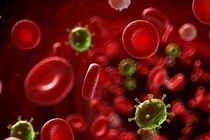 Nhiễm trùng huyết nguy kịch chỉ do ho sốt và mọc mụn?