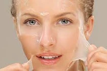 “Peel da” tại nhà cẩn thận tai biến