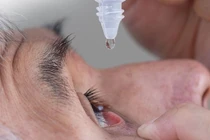 Đau mắt đỏ dùng thuốc gì?