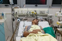 Tim phổi nhân tạo cứu bệnh nhân nhồi máu cơ tim, sốc tim, ngừng tuần hoàn