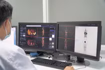 Bác sĩ đang theo dõi kết quả chụp PET/CT trên màn hình.