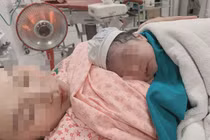 Cấp cứu sản phụ đẻ rơi con gần 4kg trên taxi