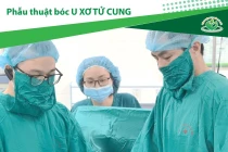 Bụng to bất thường, phụ nữ 41 tuổi mang u xơ tử cung nặng 3 kg