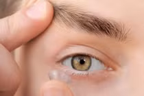 Biến chứng nếu đeo kính áp tròng sai cách
