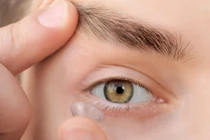 Biến chứng nếu đeo kính áp tròng sai cách
