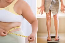 Một phụ nữ 38 tuổi nguy kịch do uống thuốc giảm cân mua trên mạng