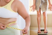 Một phụ nữ 38 tuổi nguy kịch do uống thuốc giảm cân mua trên mạng