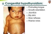 Mẹ bị bệnh tuyến giáp trong thai kỳ, con có cần sàng lọc?