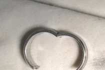 Đeo nhẫn cho “cậu nhỏ” thanh niên 16 tuổi phải cấp cứu vì bị “bóp nghẹt”