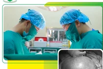 Tưởng béo bụng nào ngờ chửa trứng nặng hơn 4kg