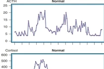Ảnh: Dao động nồng độ Cortisol và ACTH trong ngày