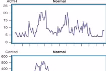 Ảnh: Dao động nồng độ Cortisol và ACTH trong ngày