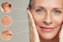 Bác sĩ chỉ rõ 5 dấu hiệu lão hoá da sớm không được bỏ qua