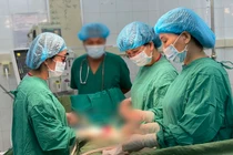 Khi nào cần phẫu thuật u xơ tử cung?