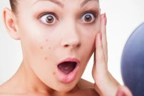 Loại bỏ sai lầm để da khỏe đẹp khi hè về