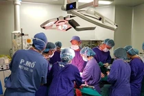 Ưu nhược điểm của hút mỡ bụng