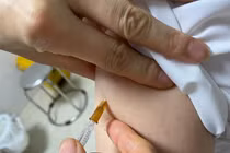 Thuốc sinh học điều trị vẩy nến