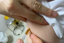 Thuốc sinh học điều trị vẩy nến