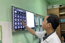 Đặt điện cực kích thích não sâu điều trị Parkinson