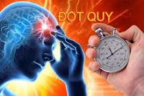 Bác sĩ chỉ rõ những quan niệm sai lầm về đột quỵ não