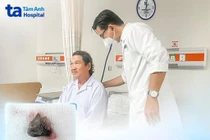 Thích gặm xương người đàn ông bị xương 2 cm găm trong phổi gây mô hạt