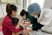 Trẻ 4 tuổi bị chó Pit Bul dại tấn công, hàng chục vết khâu ở mặt