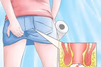 Nguy cơ bệnh nguy hiểm nếu chủ quan với ngứa hậu môn