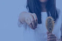 Vì sao người trẻ tuổi lại bị rụng tóc nhiều?