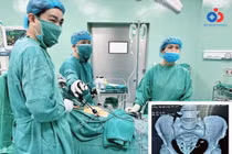 2 người bị dụng cụ tránh thai xuyên thủng ruột