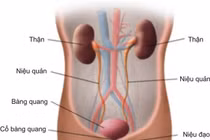 Bỏ dở điều trị bệnh thận mạn tính, trẻ sẽ tử vong