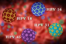 Bác sĩ chỉ rõ dương tính HPV có phải mắc ung thư cổ tử cung?