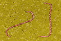 Du lịch rừng, suối cẩn thận mắc xoắn khuẩn Leptospira gây suy đa tạng