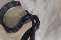 Nam giới 18 – 50 cẩn thận viêm mào tinh hoàn gây vô sinh