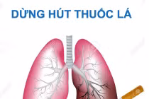 Bác sĩ chỉ rõ đối tượng cần tầm soát ung thư phổi: đừng để quá muộn