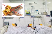 Thịt cóc ăn chữa còi xương 3 mẹ con nhập viện cấp cứu