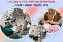 3 lần mổ cứu trẻ sơ sinh bị nội tạng thòi hết ra khỏi ổ bụng