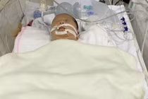 Chậm tiêu dịch phổi – nguy cơ trẻ sơ sinh mổ đẻ phải đối mặt