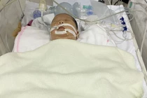 Chậm tiêu dịch phổi – nguy cơ trẻ sơ sinh mổ đẻ phải đối mặt