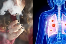 Nhiều học sinh hôn mê, tử vong vì thuốc lá điện tử, nung nóng, shisha