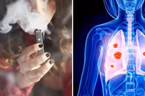 Nhiều học sinh hôn mê, tử vong vì thuốc lá điện tử, nung nóng, shisha