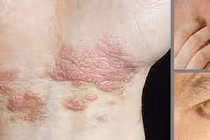 Dấu hiệu bất thường vào buổi sáng báo hiệu bệnh gan mọi người thường bỏ qua