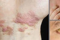 Dấu hiệu bất thường vào buổi sáng báo hiệu bệnh gan mọi người thường bỏ qua