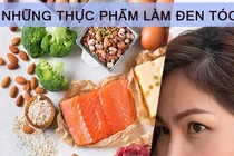 Món ăn bổ thận ngừa tóc bạc sớm