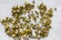 Biết cơ chế hình thành sỏi mật để phòng chữa hiệu quả