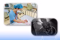 Cứu sống mẹ con sản phụ bị rau bong non thể nặng