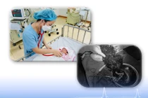 Cứu sống mẹ con sản phụ bị rau bong non thể nặng