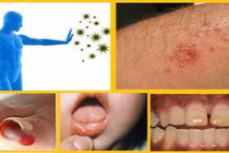 Bệnh nhân đái tháo đường dễ nhiễm trùng và tử vong